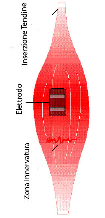 elettrostimolatore come posizionare elettrodi